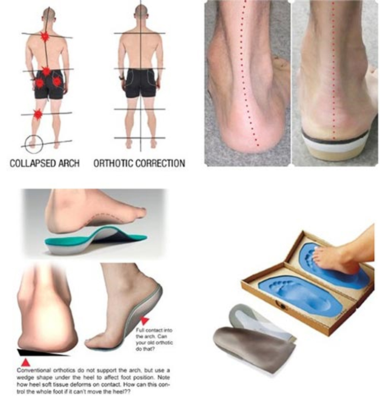 Chiropractic Sterling VA Custom Made Orthotics