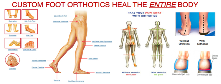 Chiropractic Sterling VA Orthotics